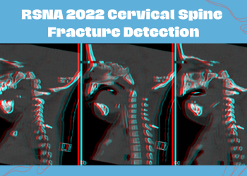 RSNA 2022 Cervical Spine Fracture Detection