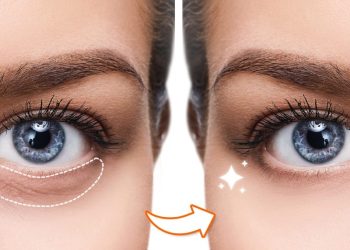 Propose an idea for caring for dark circles and signs of aging under your eyes