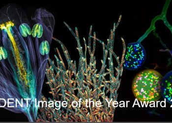 The Evident Image of the Year–Scientific Microscopy Award