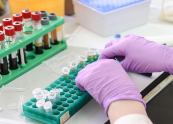 Preventing post-thaw decrease in calcium concentration in a serum-based liquid formulation