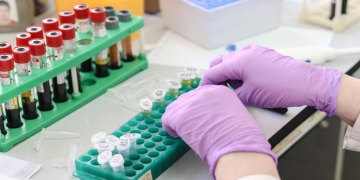 Preventing post-thaw decrease in calcium concentration in a serum-based liquid formulation